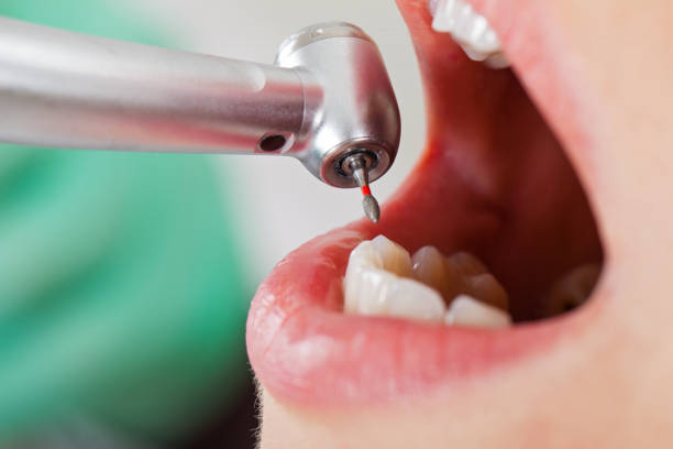 Best Emergency Treatment for Oral Infections in Mvell, AR